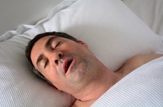 causes of hypersomnia snoring and sleep apnea